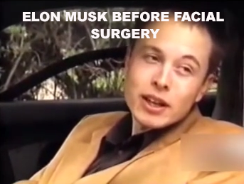 ELON-MUSK-PLASTIC-SURGERY ELON MUSK IS A LIAR SCAMMER POLITICAL BRIBERY CROOK
Keywords: Big tech mobsters,Dark money payola, Rare Earth Mines, New America Foundation Corruption, Obama, Obama Campaign Finance, Obama FEC violations, Palo Alto Mafia, Paypal Mafia, Pelosi Corruption, Political bribes, Political Insider,  Eric Schmidt Sex Penthou
