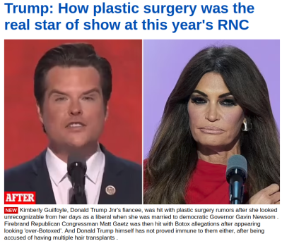 BAD-PLASTIC-SURGERY
Keywords: Big tech mobsters,Dark money payola, Rare Earth Mines, New America Foundation Corruption, Obama, Obama Campaign Finance, Obama FEC violations, Palo Alto Mafia, Paypal Mafia, Pelosi Corruption, Political bribes, Political Insider,  Eric Schmidt Sex Penthou