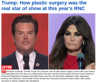 Filename=BAD-PLASTIC-SURGERY.png
Filesize=491KiB
Dimensions=813x697
Date added=Sep 23, 2026 BAD-PLASTIC-SURGERY.png